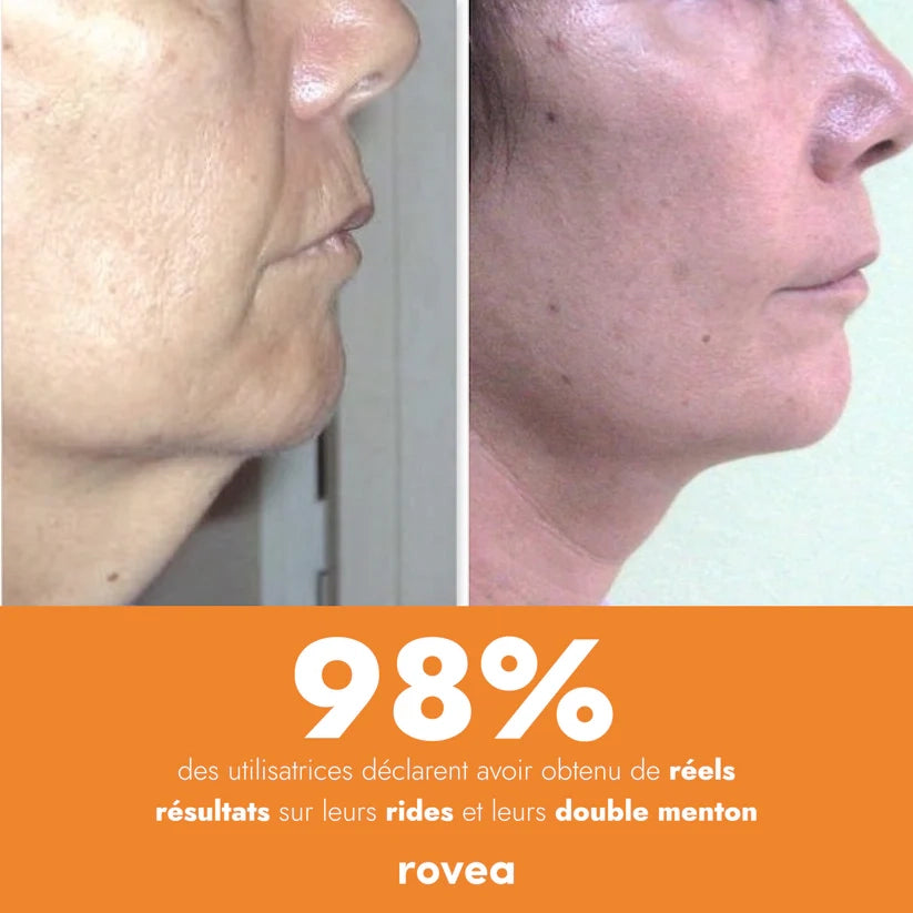 Appareil EMS - Rajeunissement Facial et Cou